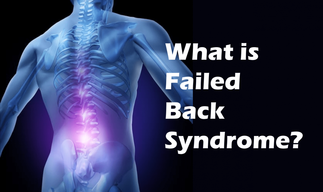 failed back syndrome